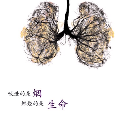 晚期肺癌扩散的症状几大表现 晚期肺癌扩散的症状几大表现