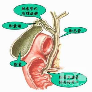 胆管癌,护理
