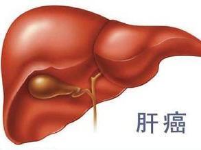 中医治疗肝癌的作用 中医治疗肝癌的作用